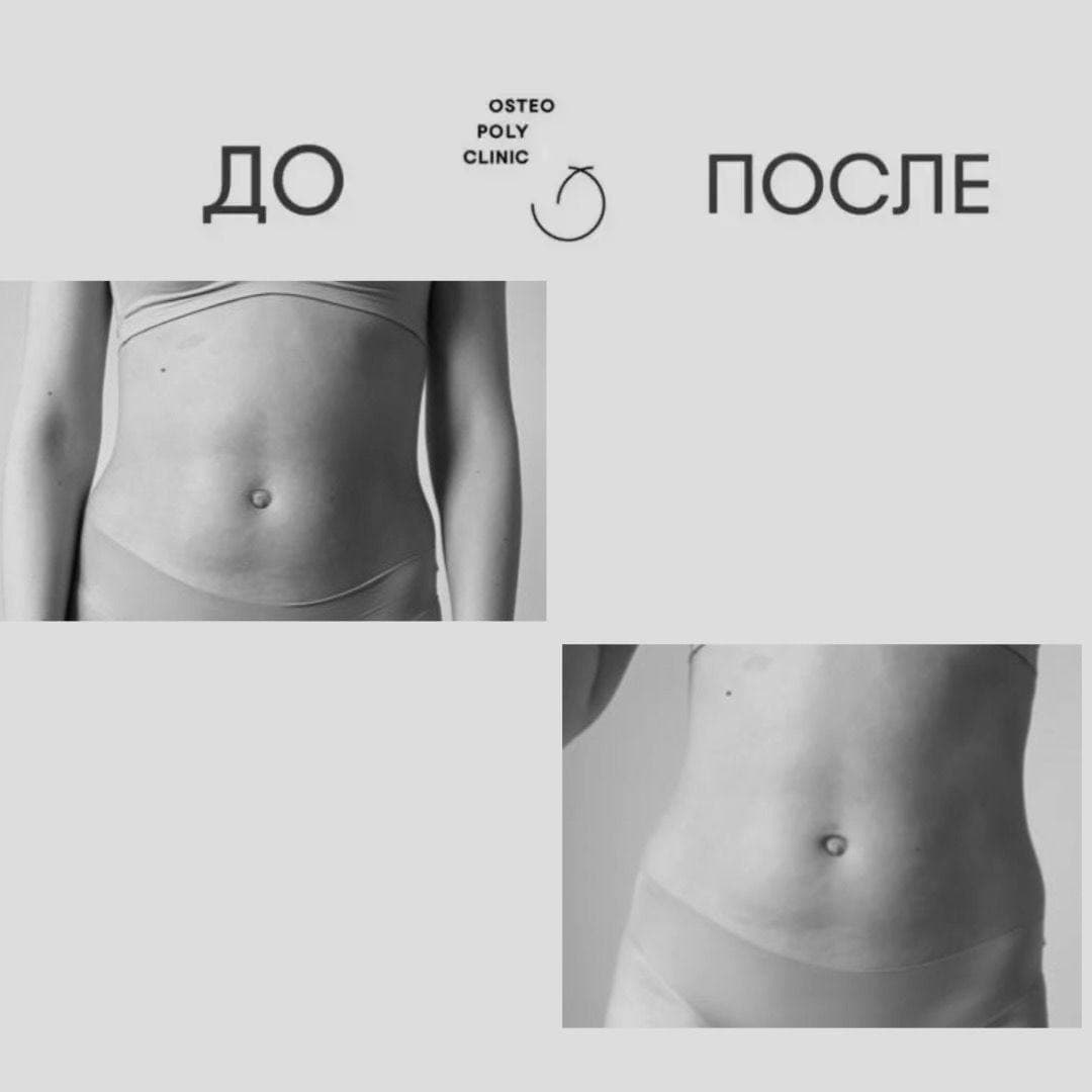 Почему не могу убрать живот? Почему не могу убрать живот?