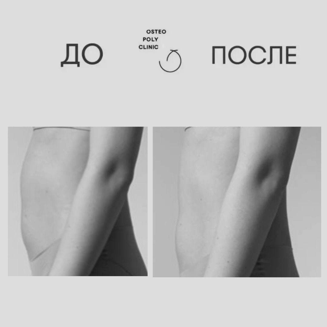 Почему не могу убрать живот? Почему не могу убрать живот?