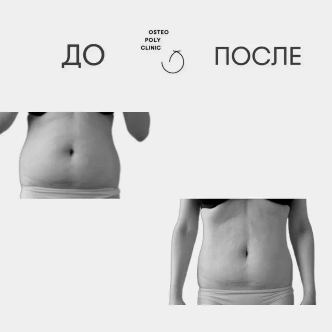 Почему не могу убрать живот? Почему не могу убрать живот?